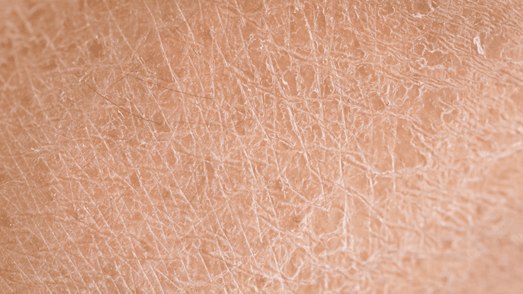 Protein helps collagen and elastin, which keep your skin firm and moist. If you don’t consume enough protein, your skin may become dry and flaky