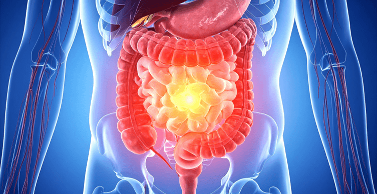 Image of Signs of Poor Gut Health You Shouldn’t Ignore